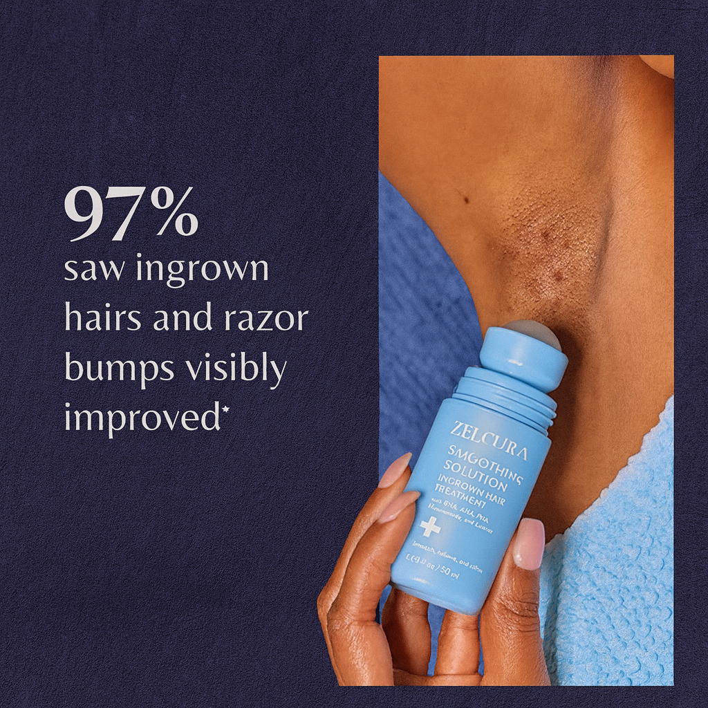 Zelcura™ - Smoothing Solution Ingrown Hair Treatment