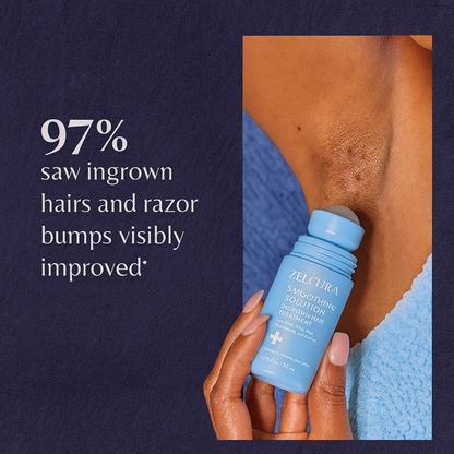 Zelcura™ - Smoothing Solution Ingrown Hair Treatment