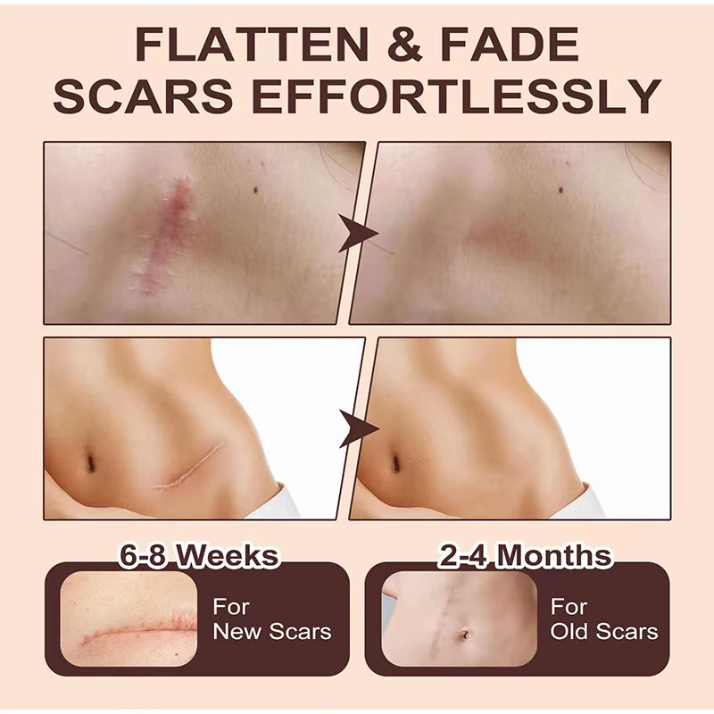 Zelcura™ – Silicone Scar Stick