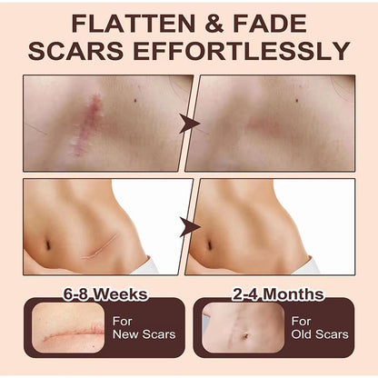 Zelcura™ – Silicone Scar Stick