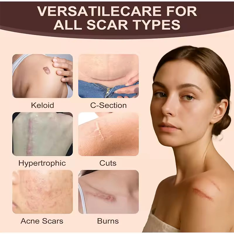 Zelcura™ – Silicone Scar Stick